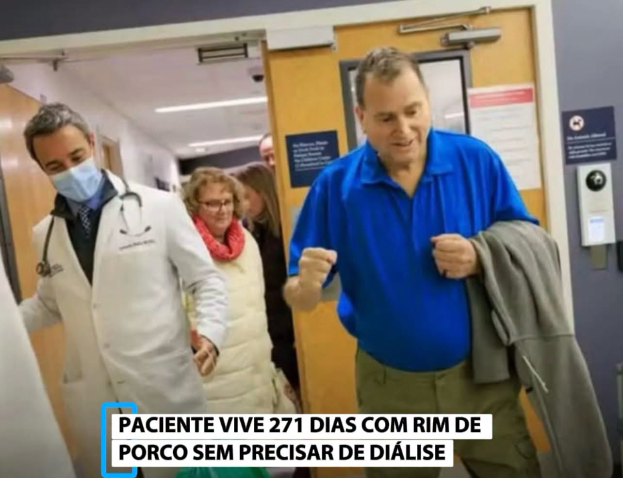 PACIENTE VIVE 271 DIAS COM RIM DE PORCO SEM PRECISAR DE DIÁLISE