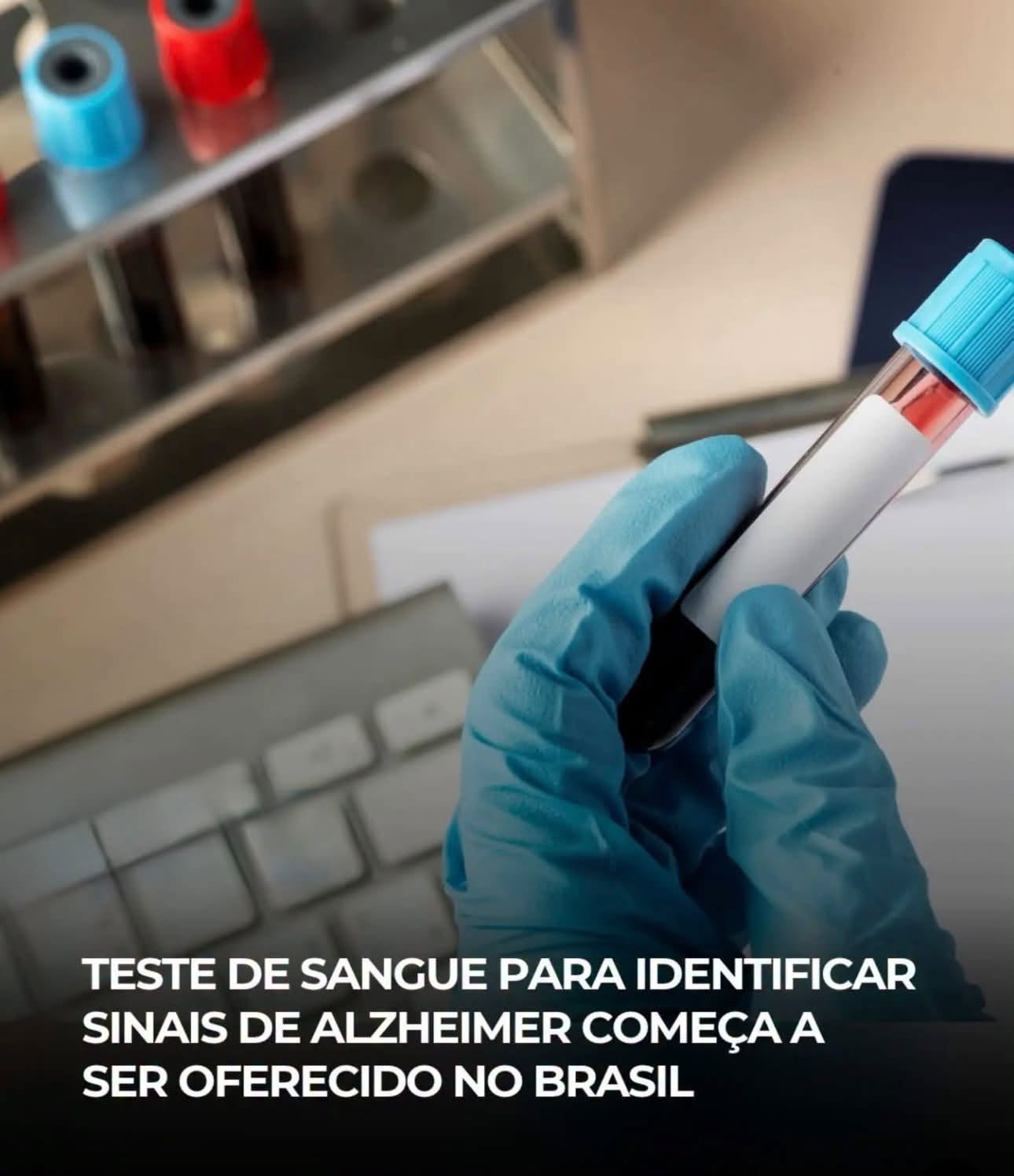 TESTE DE SANGUE PARA IDENTIFICAR SINAIS DE ALZHEIMER COMEÇA A SER OFERECIDO NO BRASIL